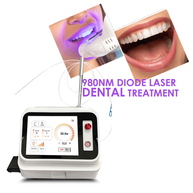 2024 Hot Sale Dental Soft Tiss - Teeth Whitening With Laser ulasan dan harga
