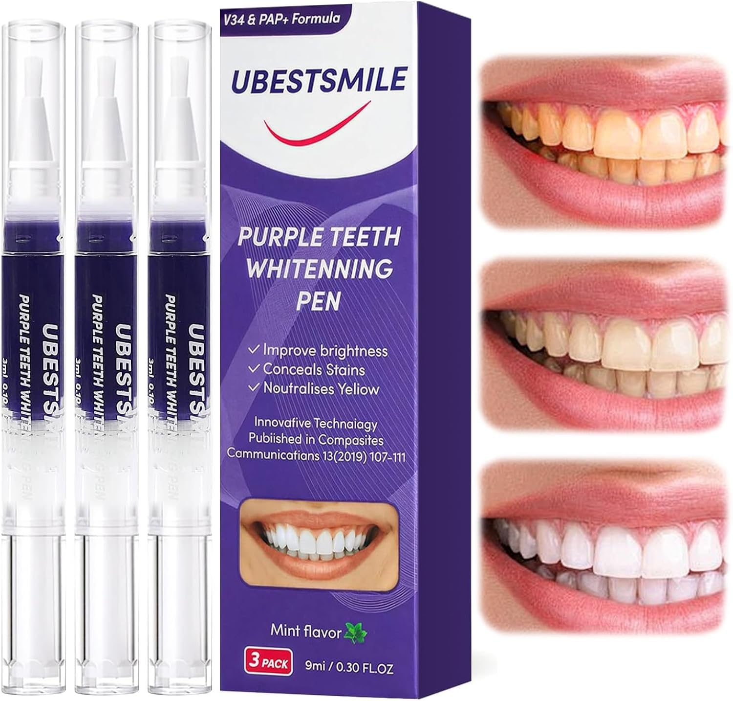 UBESTSMILE V34&PAP+ Formula Pu - Teeth Whitening Pens ulasan dan harga