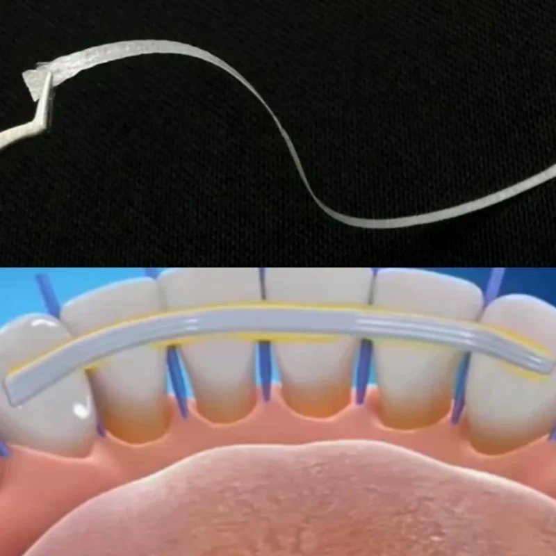 1Pc Dental Flexible Fiber Stri - Teeth Whitening Strips Lumineux ulasan dan harga